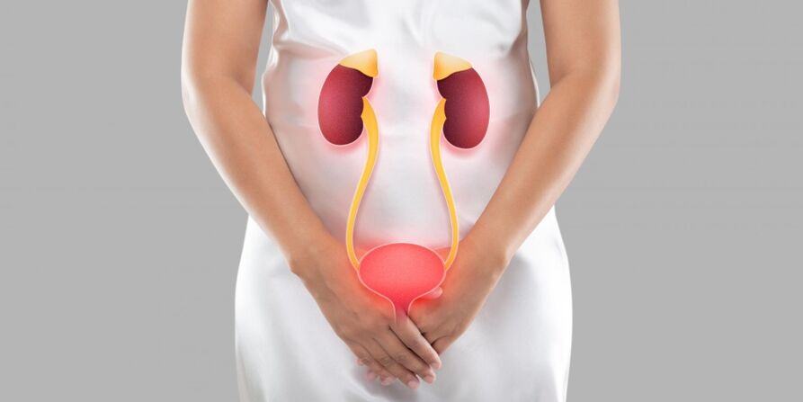 Cistita feminină este o inflamație care apare în țesuturile vezicii urinare